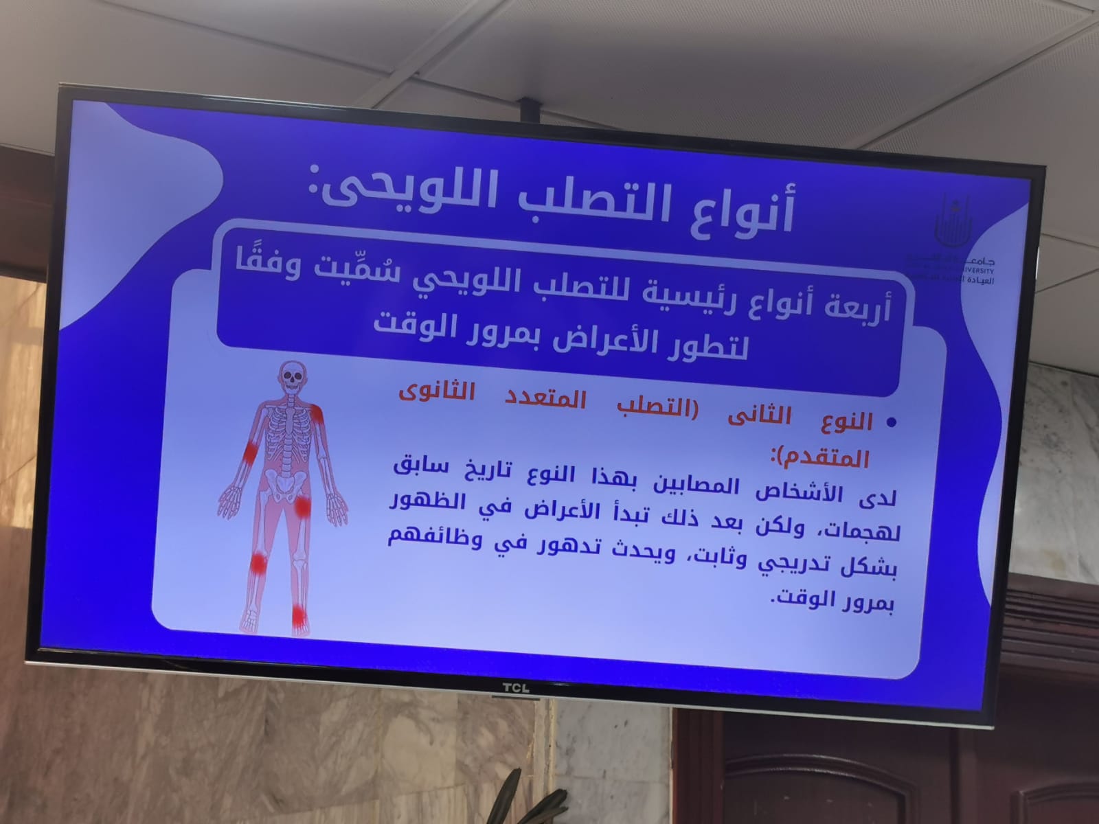 فعلت العيادة الطبية الجامعية التوعية الصحية عن التصلب اللويحي