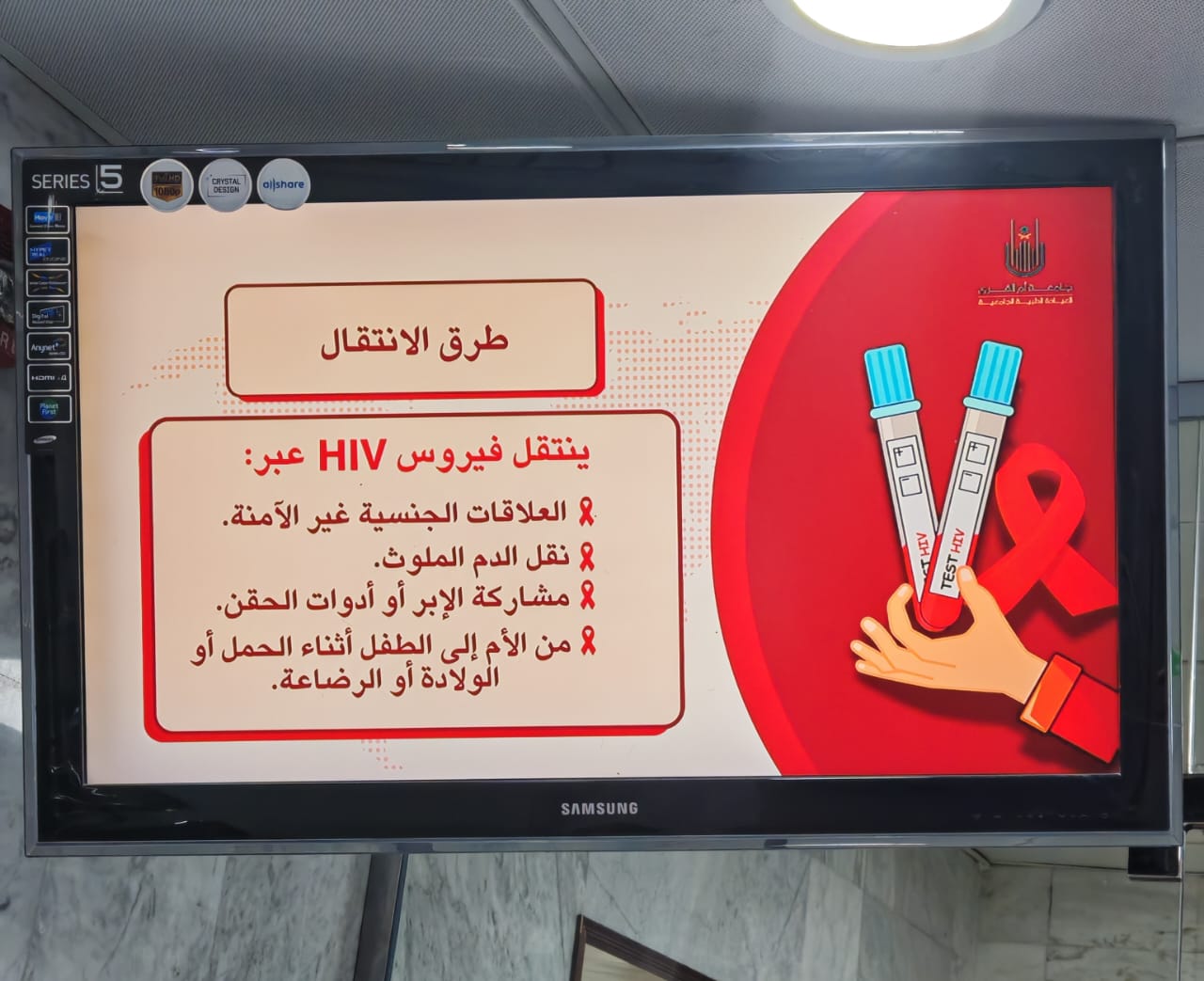 فعلت العيادة الطبية الجامعية التوعية الصحية عن مرض نقص المناعة المكتسب